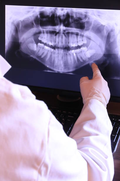 Best Broken or Chipped Tooth Repair in Lesslie, SC